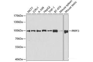 Western blot analysis of extracts of various cell lines using PRPF3 Polyclonal Antibody at dilution of 1:1000. (PRPF3 anticorps)