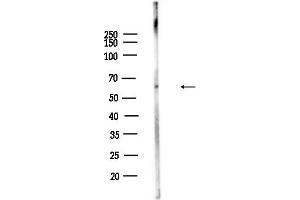 Western blot analysis of lysates from EC304 cells, using Phospho-C (Tyr531) Antibody at 1/1000 dilution.