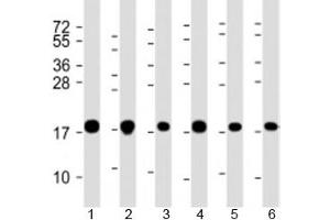 Western blot testing of human 1) A549, 2) HeLa, 3) HepG2, 4) U-2OS, 5) Jurkat and 6) placenta lysate with COMMD1 antibody at 1:2000. (COMMD1 anticorps  (AA 4-33))