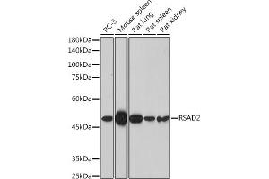 Western blot analysis of extracts of various cell lines, using RS antibody (ABIN7269832) at 1:1000 dilution. (RSAD2 anticorps  (AA 42-361))