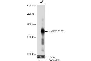 Western blot analysis of extracts of Raji cells, using Phospho-SHIP1-Y1020 antibody (ABIN6135243, ABIN6136110, ABIN6136111 and ABIN6225677) at 1:1000 dilution. (INPP5D anticorps  (pTyr1020))