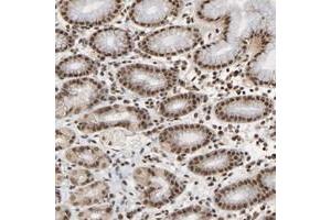 Immunohistochemical staining of human stomach with ZNF384 polyclonal antibody  shows strong nuclear positivity in glandular cells at 1:50-1:200 dilution. (ZNF384 anticorps)