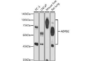 Western blot analysis of extracts of various cell lines, using  antibody (ABIN3022783, ABIN3022784, ABIN3022785 and ABIN6219227) at 1:500 dilution.