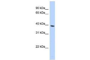 SPON2 antibody used at 1 ug/ml to detect target protein. (SPON2 anticorps  (N-Term))