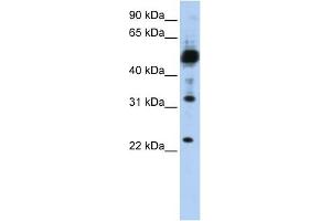 TMEM38B antibody used at 1 ug/ml to detect target protein. (TMEM38B anticorps  (C-Term))