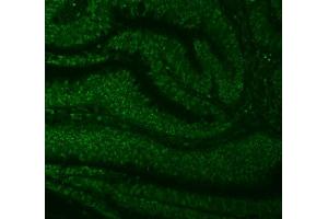 IF analysis of SNRNP27 using anti-SNRNP27 antibody (ABIN7599614). (SNRNP27 anticorps  (AA 100-155))