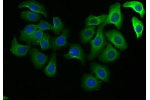 Immunofluorescence staining of A549 cells with ABIN7150750 at 1:100, counter-stained with DAPI.