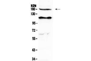 Western blot analysis of VEGF Receptor 2  using anti-VEGF Receptor 2  antibody . (VEGFR2/CD309 anticorps  (AA 20-242))