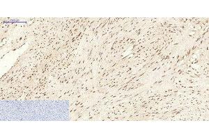 Immunohistochemistry of paraffin-embedded Human uterus tissue using CBX5 Monoclonal Antibody at dilution of 1:200.