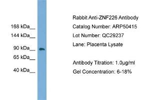 WB Suggested Anti-ZNF226  Antibody Titration: 0. (ZNF226 anticorps  (Middle Region))
