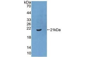 Detection of Recombinant XPo1, Human using Polyclonal Antibody to Exportin 1 (XPO1) (XPO1 anticorps  (AA 917-1071))