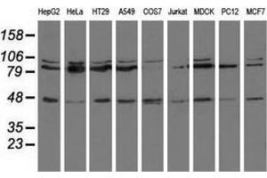 Western blot analysis of extracts (35 µg) from 9 different cell lines by using anti-CD80 monoclonal antibody. (CD80 anticorps)