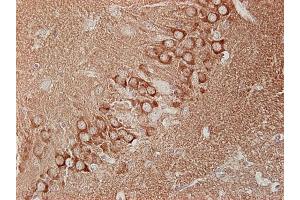 Immunohistochemistry (IHC) image for anti-Dynamin 1, 2, 3 (AA 2-17) antibody (ABIN1742248) (Dynamin 1, 2, 3 (AA 2-17) anticorps)