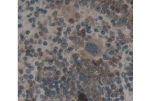 IHC-P analysis of Mouse Tissue, with DAB staining. (TRADD anticorps  (AA 21-259))