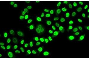 Immunofluorescence analysis of HeLa cells using NUDC Polyclonal Antibody (NUDC anticorps)