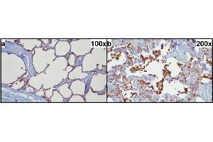Typical pulmonal findings in SP-A (surfactant protein A) immunohistochemistry. (Surfactant Protein A1 anticorps  (Internal Region))