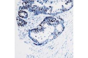 Immunohistochemistry (IHC) image for anti-SWI/SNF Related, Matrix Associated, Actin Dependent Regulator of Chromatin, Subfamily E, Member 1 (SMARCE1) antibody (ABIN7308352)