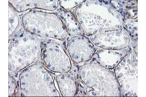 Immunohistochemical staining of paraffin-embedded Human Kidney tissue using anti-LDLRAP1 mouse monoclonal antibody. (LDLRAP1 anticorps)
