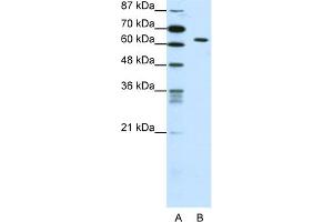 WB Suggested Anti-SMAD1 Antibody Titration:  0. (SMAD1 anticorps  (C-Term))