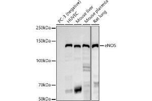 Western blot analysis of extracts of various cell lines, using eNOS antibody (ABIN7268920) at 1:1000 dilution. (ENOS anticorps)