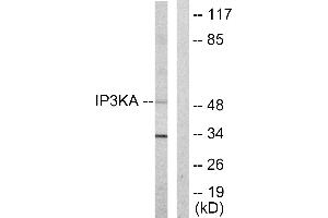 Western blot analysis of extracts from HUVEC cells, using IP3KA antibody.