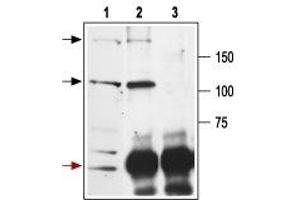 Immunoprecipitation of rat brain lysates - 1.