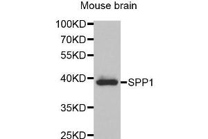 Western Blotting (WB) image for anti-Secreted phosphoprotein 1 (SPP1) (AA 17-314) antibody (ABIN3021922) (Osteopontin anticorps  (AA 17-314))