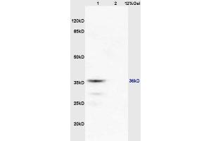 Lane 1: mouse brain lysates Lane 2: mouse kidney lysates probed with Anti RASSF2 Polyclonal Antibody, Unconjugated (ABIN681988) at 1:200 in 4 °C.
