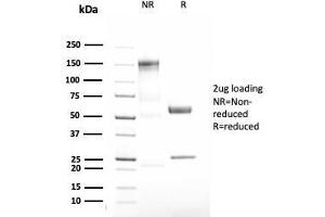SDS-PAGE Analysis Purified Alpha-1-Antitrypsin Recombinant Rabbit Monoclonal (AAT/3167R). (Recombinant SERPINA1 anticorps)