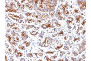 Formalin-fixed, paraffin-embedded human Pancreas stained with CFTR Monoclonal Antibody (SPM176). (CFTR anticorps)