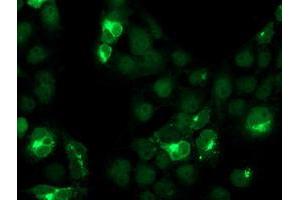 Image no. 3 for anti-Cystatin S (CST4) antibody (ABIN1497667)