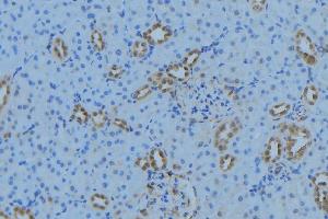 ABIN6279021 at 1/100 staining Mouse kidney tissue by IHC-P. (MRPL34 anticorps  (Internal Region))