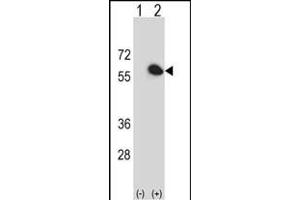 Western blot analysis of FKBP4 (arrow) using rabbit polyclonal FKBP4 Antibody (Center) (ABIN391579 and ABIN2841513). (FKBP4 anticorps  (AA 186-216))