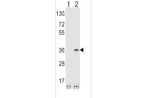 Western blot analysis of SULT1A1 using rabbit polyclonal SULT1A1 Antibody (Y143) using 293 cell lysates (2 ug/lane) either nontransfected (Lane 1) or transiently transfected (Lane 2) with the SULT1A1 gene. (SULT1A1 anticorps  (AA 128-160))