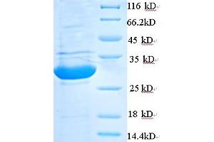 SDS-PAGE (SDS) image for phospholipase A2, Group V (PLA2G5) (AA 21-137) protein (His-SUMO Tag) (ABIN5710109)