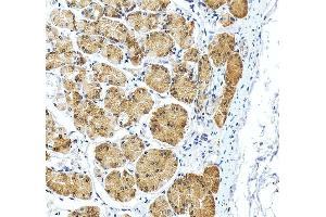 IHC analysis of RPS2 using anti-RPS2 antibody (ABIN7601997). (RPS2 anticorps  (AA 54-293))