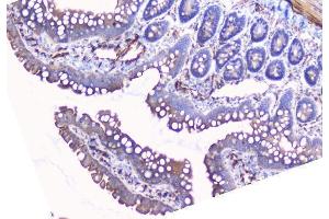 IHC analysis of Aromatase using anti-Aromatase antibody (ABIN6719449).