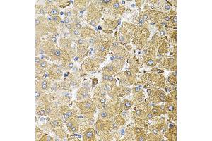 Immunohistochemistry of paraffin-embedded human liver injury using CEP164 antibody (ABIN6003672) (40x lens). (CEP164 anticorps)