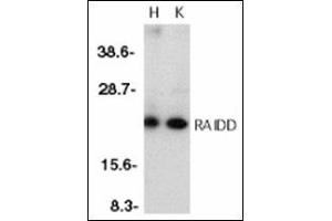 Western blot analysis of RAIDD in whole cell lysates from HeLa (H) or K562 (K) cells with RAIDD antibody at 1 µg/ml (CRADD anticorps  (Middle Region))