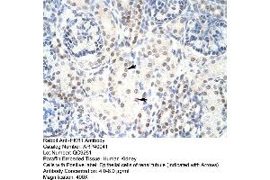 Human kidney (HKR1 anticorps  (C-Term))