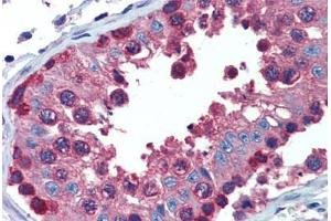 Testis, Human: Formalin-Fixed, Paraffin-Embedded (FFPE)