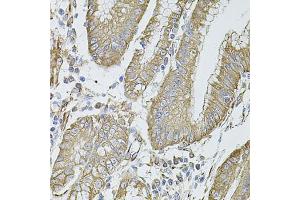 Immunohistochemistry of paraffin-embedded human stomach using FLNB antibody (ABIN5971317) at dilution of 1/100 (40x lens). (FLNB anticorps)