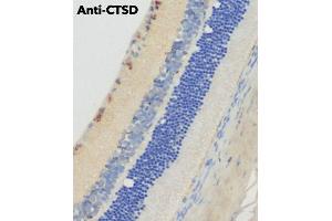 Immunohistochemistry (IHC) image for anti-Cathepsin D (CTSD) (C-Term) antibody (ABIN6254162) (Cathepsin D anticorps  (C-Term))