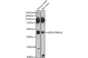 Immunofluorescence analysis of U2OS cells using ATGL/PNPL antibody (ABIN6132218, ABIN6145857, ABIN6145858 and ABIN6221844) at dilution of 1:100. (PNPLA2 anticorps  (AA 265-504))