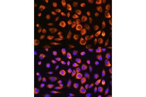 anti-Heat Shock 70kDa Protein 8 (HSPA8) (AA 1-300) antibody
