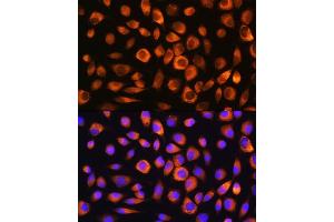 Immunofluorescence analysis of L929 cells using Hsc70/HSP Rabbit pAb (ABIN3016123, ABIN3016124, ABIN3016125 and ABIN6219558) at dilution of 1:100. (Hsc70 anticorps  (AA 1-300))