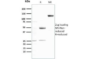SDS-PAGE Analysis Purified Ubiquitin Recombinant Rabbit Monoclonal Antibody (UBB/3143R). (Recombinant Ubiquitin B anticorps  (AA 1-119))