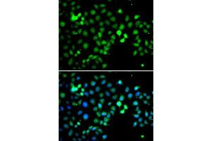 Immunofluorescence analysis of A549 cells using MTF2 antibody. (MTF2 anticorps  (AA 1-190))