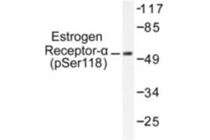 Image no. 1 for anti-Estrogen Receptor 1 (ESR1) (pSer118) antibody (ABIN318018) (Estrogen Receptor alpha anticorps  (pSer118))