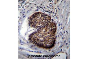 Immunohistochemistry (IHC) image for anti-Prostate Stem Cell Antigen (PSCA) antibody (ABIN2997805) (PSCA anticorps)